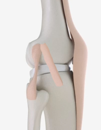 nouveau ligament du genou chirurgiedusport herman lefevre bohu