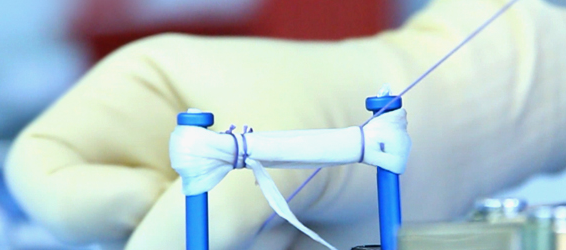 Radiologie 3D femur